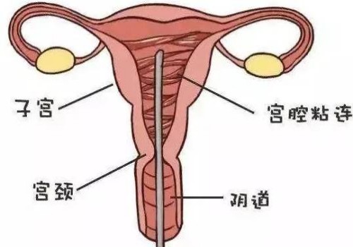 无锡正规助孕机构：中信湘雅可申请供精试管婴儿，前提还要满足这些适应症